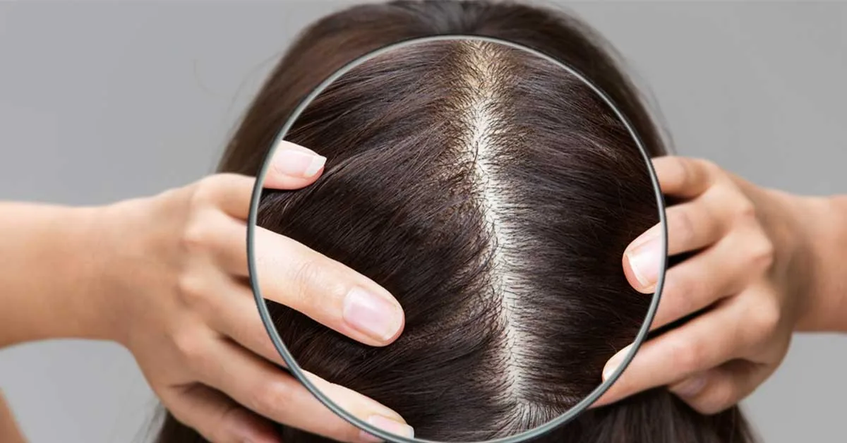 Hands parting dark hair with a magnifying glass over the scalp